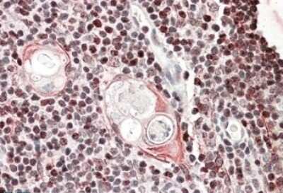 Immunohistochemistry-Paraffin: SATB1 Antibody [NBP1-51960] - (3.8ug/ml) staining of paraffin embedded Human Thymus. Steamed antigen retrieval with citrate buffer pH 6, AP-staining.