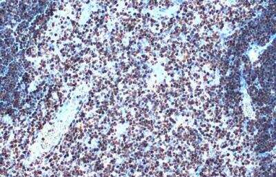 Immunohistochemistry-Paraffin: SATB1 Antibody [NBP2-15107] -  Mouse thymus gland. SATB1 stained by SATB1 antibody [C2C3], C-term  diluted at 1:500. Antigen Retrieval: Citra 