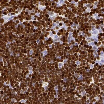 Immunohistochemistry-Paraffin: SATB1 Antibody [NBP2-54994] - Staining of human thymus shows strong nuclear positivity in cortical cells.