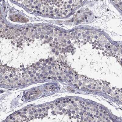 Immunohistochemistry-Paraffin: SATB1 Antibody [NBP3-17001] - Staining of human testis shows high expression.