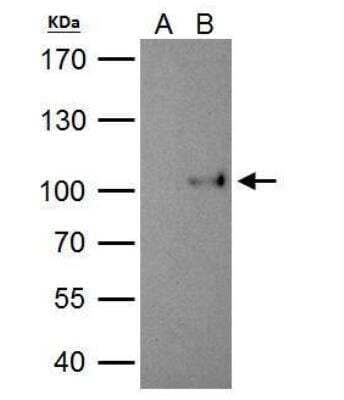 Immunoprecipitation: SATB1 Antibody [NBP2-15107] - 293T whole cell lysate/extract A. Control with 2 ug of preimmune rabbit IgG B. Immunoprecipitation of SATB1 protein by 2 ug of SATB1 antibody 7.5% SDS-PAGE The immunoprecipitated SATB1 protein was detected by SATB1 antibody  diluted at 1:1000. EasyBlot anti-rabbit IgG was used as a secondary reagent.