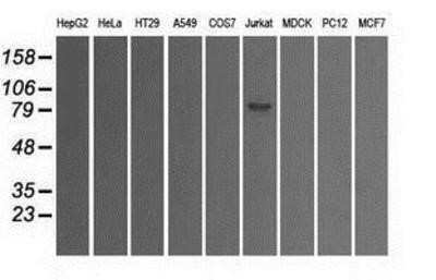 Western Blot: SATB1 Antibody (OTI13D6) - Azide and BSA Free [NBP2-73991] - Analysis of extracts (35ug) from 9 different cell lines by using anti-SATB1 monoclonal antibody.