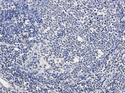 Immunohistochemistry-Paraffin: SATB1 Antibody (S03-5H7) [NBP3-19810] - Immunohistochemistry of SATB1 in paraffin-embedded Human tonsil using NBP3-19810 at dilution 1/50