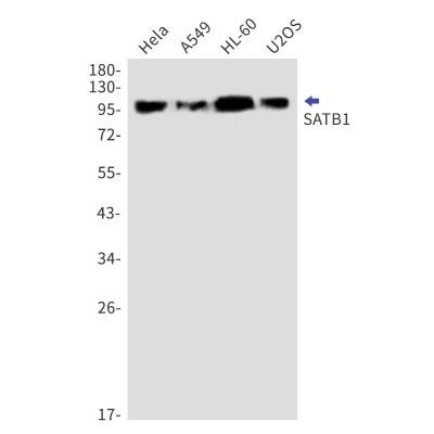 Western Blot: SATB1 Antibody (S03-5H7) [NBP3-19810] - Western blot detection of SATB1 in Hela, A549, HL-60, U2OS cell lysates using NBP3-19810 (1:1000 diluted). Predicted band size: 86kDa. Observed band size: 100kDa.