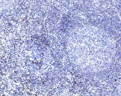 Immunohistochemistry-Paraffin: SATB1 Antibody (SP05-03) [NBP2-67371] - Analysis of paraffin-embedded human tonsil tissue using anti-SATB1 antibody.  The section was pre-treated using heat mediated antigen retrieval with sodium citrate buffer (pH 6.0) for 20 minutes. The tissues were blocked in 5% BSA for 30 minutes at room temperature, washed with ddH2O and PBS, and then probed with the primary antibody (1/200) for 30 minutes at room temperature. The detection was performed using an HRP conjugated compact polymer system. DAB was used as the chromogen. Tissues were counterstained with hematoxylin and mounted with DPX.