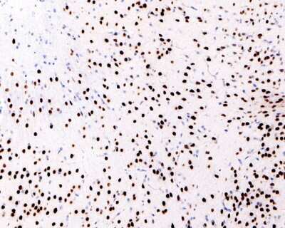 Immunohistochemistry-Paraffin: SATB1 Antibody (SP05-03) [NBP2-67371] - Analysis of paraffin-embedded mouse brain tissue using anti-SATB1 antibody.  The section was pre-treated using heat mediated antigen retrieval with sodium citrate buffer (pH 6.0) for 20 minutes. The tissues were blocked in 5% BSA for 30 minutes at room temperature, washed with ddH2O and PBS, and then probed with the primary antibody (1/200) for 30 minutes at room temperature. The detection was performed using an HRP conjugated compact polymer system. DAB was used as the chromogen. Tissues were counterstained with hematoxylin and mounted with DPX.