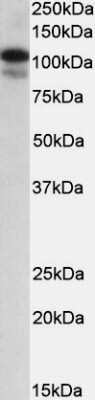 Western Blot: SATB1 Antibody [NBP1-51960] - NBP1-51960 (0.3ug/ml) staining of MOLT4 lysate (35ug protein in RIPA buffer). Primary incubation was 1 hour. Detected by chemiluminescence.