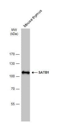 Western Blot: SATB1 Antibody [NBP2-15107] - Mouse tissue extract (50 ug) was separated by 7.5% SDS-PAGE, and the membrane was blotted with SATB1 antibody [C2C3], C-term diluted at 1:5000. The HRP-conjugated anti-rabbit IgG antibody (NBP2-19301) was used to detect the primary antibody.