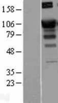 Western Blot SATB1 Overexpression Lysate