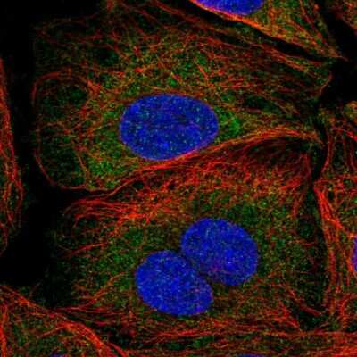 <b>Orthogonal Strategies Validation. </b>Immunocytochemistry/Immunofluorescence: SAV1 Antibody [NBP2-13282] - Staining of human cell line SiHa shows localization to cytosol. Antibody staining is shown in green.