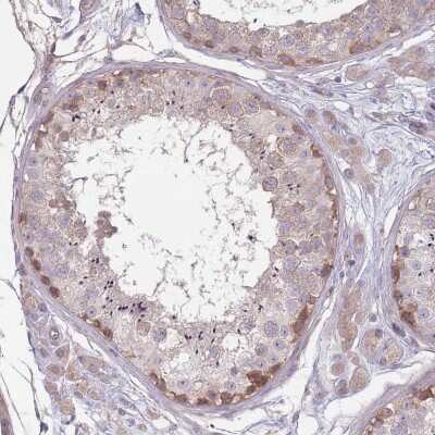 Immunohistochemistry-Paraffin: SAV1 Antibody [NBP2-13282] - Staining of human testis shows moderate cytoplasmic positivity in cells in seminiferous ducts.