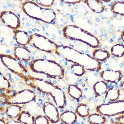 Immunohistochemistry-Paraffin: SAV1 Antibody [NBP3-15584] - Immunohistochemistry of paraffin-embedded Mouse kidney using [KO Validated] SAV1 Rabbit pAb (NBP3-15584) at dilution of 1:100 (40x lens).Perform microwave antigen retrieval with 10 mM PBS buffer pH 7.2 before commencing with IHC staining protocol.