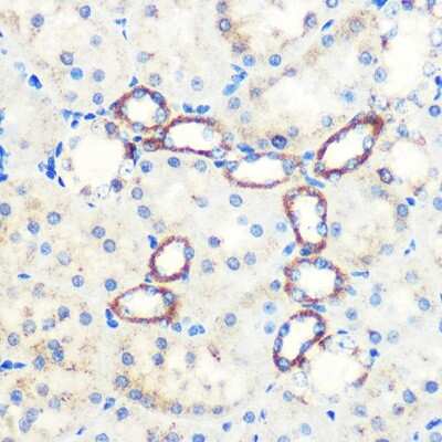 Immunohistochemistry-Paraffin: SAV1 Antibody [NBP3-15584] - Immunohistochemistry of paraffin-embedded Rat kidney using [KO Validated] SAV1 Rabbit pAb (NBP3-15584) at dilution of 1:100 (40x lens).Perform microwave antigen retrieval with 10 mM PBS buffer pH 7.2 before commencing with IHC staining protocol.