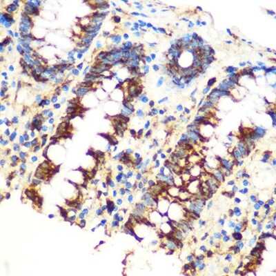 Immunohistochemistry-Paraffin: SAV1 Antibody [NBP3-15584] - Immunohistochemistry of paraffin-embedded Human colon using [KO Validated] SAV1 Rabbit pAb (NBP3-15584) at dilution of 1:100 (40x lens).Perform microwave antigen retrieval with 10 mM PBS buffer pH 7.2 before commencing with IHC staining protocol.