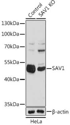 <b>Genetic Strategies Validation. </b>Knockout Validated: SAV1 Antibody [NBP3-15584] - Western blot analysis of extracts from normal (control) and [KO Validated] SAV1 knockout (KO) HeLa cells, using [KO Validated] SAV1 antibody (NBP3-15584) at 1:1000 dilution. Secondary antibody: HRP Goat Anti-Rabbit IgG (H+L) at 1:10000 dilution. Lysates/proteins: 25ug per lane. Blocking buffer: 3% nonfat dry milk in TBST. Detection: ECL Basic Kit. Exposure time: 90s.