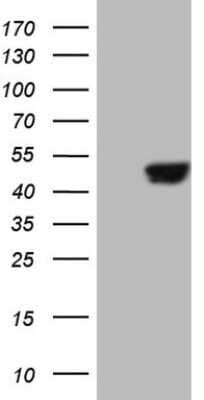 Western Blot: SAV1 Antibody (OTI2B7) - Azide and BSA Free [NBP2-73998] - Analysis of HEK293T cells were transfected with the pCMV6-ENTRY control (Left lane) or pCMV6-ENTRY SAV1 .