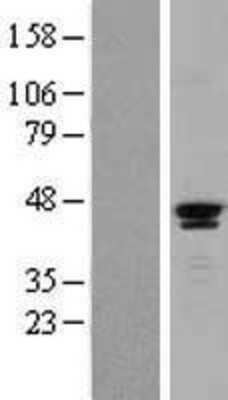 Western Blot: SAV1 Overexpression Lysate (Adult Normal) [NBL1-15703] Left-Empty vector transfected control cell lysate (HEK293 cell lysate); Right -Over-expression Lysate for SAV1.