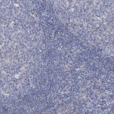Immunohistochemistry-Paraffin: SBK2 Antibody [NBP1-91020] - Staining of human tonsil shows no positivity in non-germinal center cells as expected.