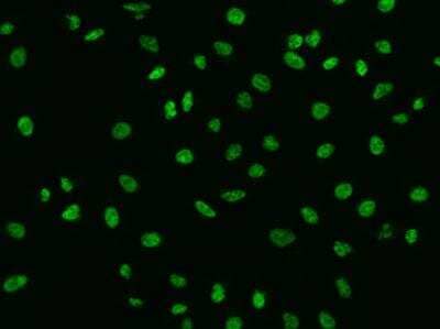 Immunocytochemistry/Immunofluorescence: SBNO1 Antibody [NBP3-05794] - Staining of SBNO1 in A549 cells. Cells were fixed with 4% PFA, permeabilzed with 0.3% Triton X-100 in PBS,blocked with 10% serum, and incubated with rabbit anti-Human SBNO1 polyclonal antibody (dilution ratio 1:200) at 4? overnight. Then cells were stained with the Alexa Fluor®488-conjugated Goat Anti-rabbit IgG secondary antibody (green). Positive staining was localized to Nucleus.