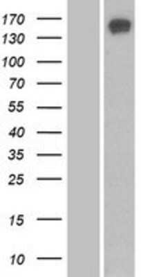 Western Blot: SBNO1 Overexpression Lysate (Adult Normal) [NBP2-06852] Left-Empty vector transfected control cell lysate (HEK293 cell lysate); Right -Over-expression Lysate for SBNO1.