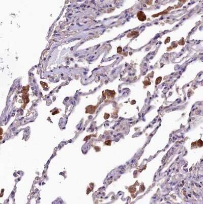 Immunohistochemistry-Paraffin: SBNO2 Antibody [NBP2-14513] - Staining of human lung shows strong cytoplasmic positivity in macrophages.