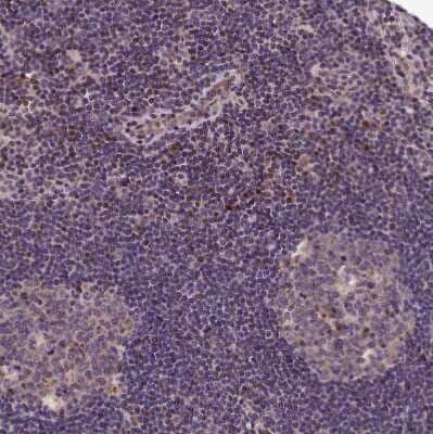 Immunohistochemistry-Paraffin: SBNO2 Antibody [NBP2-14513] - Staining of human lymph node shows moderate to strong nuclear positivity in a subset of non-germinal center cells.