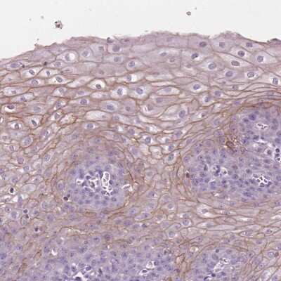 Immunohistochemistry-Paraffin: SBSN Antibody [NBP2-49369] - Staining of human esophagus shows high expression.