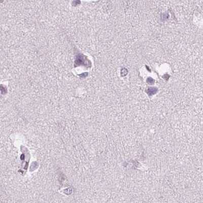 Immunohistochemistry-Paraffin: SBSN Antibody [NBP2-49369] - Staining of human cerebral cortex.