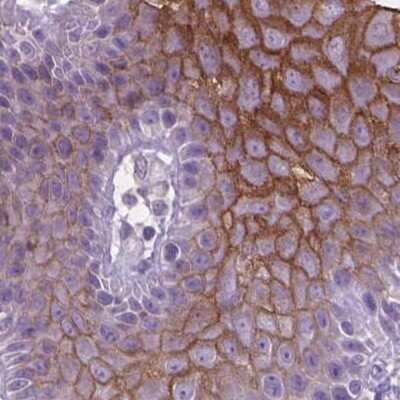 Immunohistochemistry-Paraffin: SBSN Antibody [NBP2-49369] - Staining of human skin.