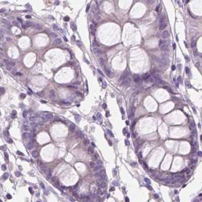Immunohistochemistry-Paraffin: SBSN Antibody [NBP2-49369] - Staining of human colon.