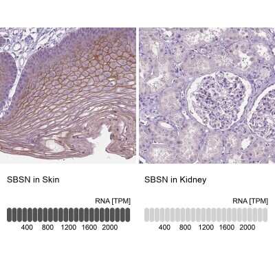 <b>Orthogonal Strategies Validation. </b>Immunohistochemistry-Paraffin: SBSN Antibody [NBP2-49369] - Analysis in human skin and kidney tissues. Corresponding SBSN RNA-seq data are presented for the same tissues.