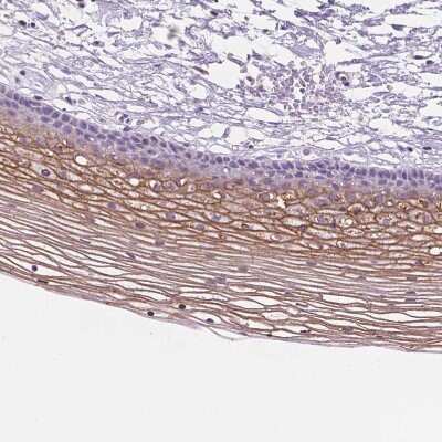 Immunohistochemistry-Paraffin: SBSN Antibody [NBP2-49369] - Staining of human cervix, uterine shows moderate membranous positivity in squamous epithelial cells.
