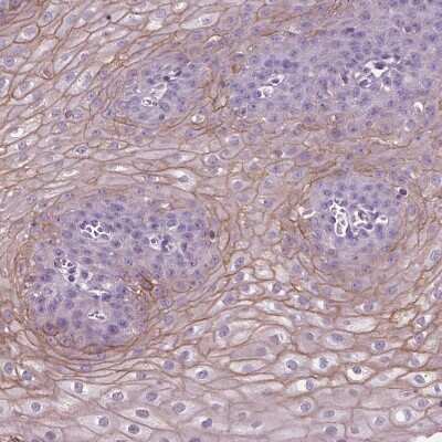 Immunohistochemistry-Paraffin: SBSN Antibody [NBP2-49369] - Staining of human esophagus shows moderate membranous positivity in squamous epithelial cells.