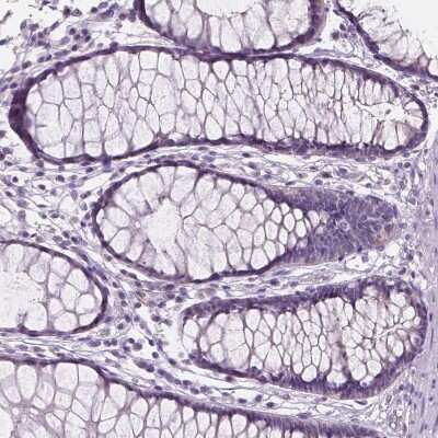 Immunohistochemistry-Paraffin: SBSN Antibody [NBP2-49369] - Staining of human rectum shows no positivity in glandular cells as expected.