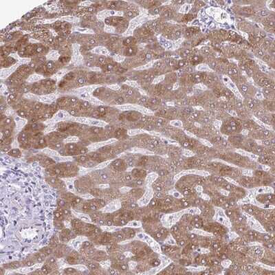 Immunohistochemistry: SC4MOL Antibody [NBP2-31624] - Staining of human liver shows moderate cytoplasmic positivity in hepatocytes.