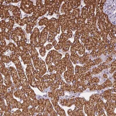 Immunohistochemistry: SC5DL Antibody [NBP2-49478] - Staining of human liver shows strong cytoplasmic positivity in hepatocytes.