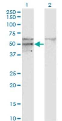 Western Blot: SC65 Antibody (1E12) [H00010609-M01] - Analysis of SC65 expression in transfected 293T cell line by SC65 monoclonal antibody (M01), clone 1E12.Lane 1: SC65 transfected lysate (Predicted MW: 50.381 KDa).Lane 2: Non-transfected lysate.