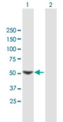 Western Blot: SC65 Antibody [H00010609-B01P] - Analysis of SC65 expression in transfected 293T cell line by SC65 polyclonal antibody.  Lane 1: SC65 transfected lysate(48.07 KDa). Lane 2: Non-transfected lysate.