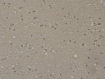 Immunohistochemistry-Paraffin: SCAI Antibody (7-A4) [NBP2-67920] - Analysis of paraffin-embedded human brain tissue using anti-SCAI antibody. Counter stained with hematoxylin.