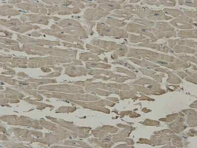 Immunohistochemistry-Paraffin: SCAI Antibody (7-A4) [NBP2-67920] - Analysis of paraffin-embedded human heart tissue using anti-SCAI antibody. Counter stained with hematoxylin.