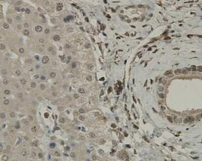 Immunohistochemistry-Paraffin: SCAI Antibody (7-A4) [NBP2-67920] - Immunohistochemical analysis of paraffin-embedded human liver tissue using anti-SCAI antibody. Counter stained with hematoxylin.