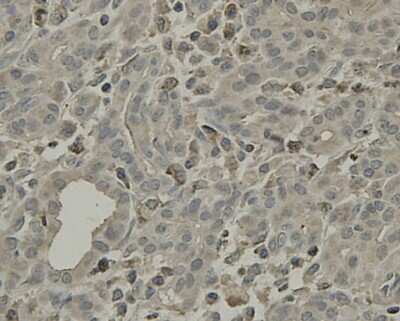 Immunohistochemistry-Paraffin: SCAI Antibody (7-A4) [NBP2-67920] - Immunohistochemical analysis of paraffin-embedded human pancreas tissue using anti-SCAI antibody. Counter stained with hematoxylin.