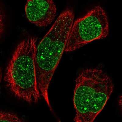 Immunocytochemistry/Immunofluorescence: SCAI Antibody [NBP1-86711] - Staining of human cell line A-431 shows localization to nucleus & nuclear membrane.