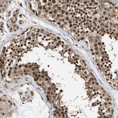 Immunohistochemistry-Paraffin: SCAI Antibody [NBP1-86711] - Staining of human testis shows strong nuclear positivity in cells in seminiferus ducts.