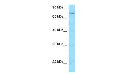 Western Blot: SCAI Antibody [NBP2-85692] - WB Suggested Anti-SCAI Antibody. Titration: 1.0 ug/ml. Positive Control: HCT15 Whole Cell