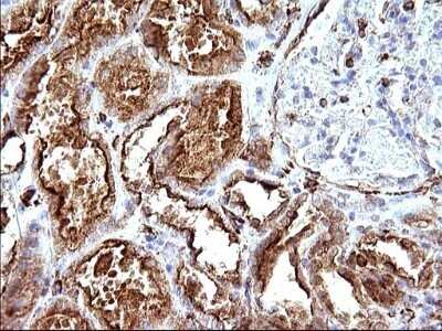 Immunohistochemistry: SCAMP2 Antibody (OTI1H10) - Azide and BSA Free [NBP2-73999] - Analysis of Human Kidney tissue. (Heat-induced epitope retrieval by 10mM citric buffer, pH6.0, 120C for 3min)