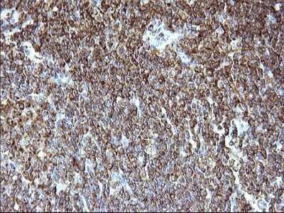 Immunohistochemistry: SCAMP2 Antibody (OTI1H10) - Azide and BSA Free [NBP2-73999] - Analysis of Human lymphoma tissue. (Heat-induced epitope retrieval by 10mM citric buffer, pH6.0, 120C for 3min)