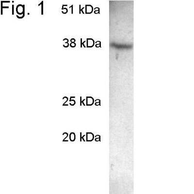 Western Blot: SCAMP2 Antibody [NB120-3431] - Analysis of SCAMP 2 on AtT20 extract.