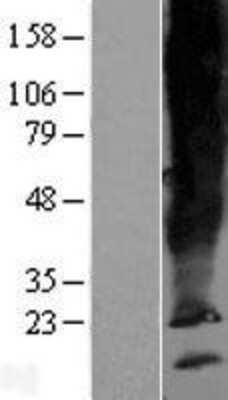 Western Blot: SCAMP5 Overexpression Lysate (Adult Normal) [NBP2-05614] Left-Empty vector transfected control cell lysate (HEK293 cell lysate); Right -Over-expression Lysate for SCAMP5.