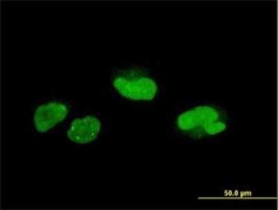 Immunocytochemistry/Immunofluorescence: SCAND1 Antibody (2F11) [H00051282-M01] - Analysis of monoclonal antibody to SCAND1 on HeLa cell . Antibody concentration 10 ug/ml.